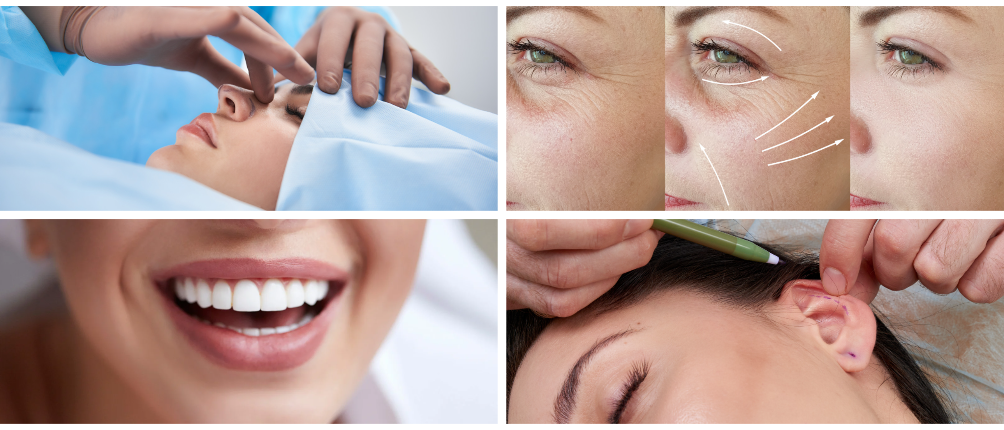 Reform International